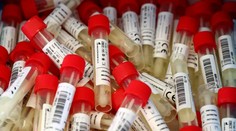 Nedeľa priniesla opäť menej ako tisíc testov a vyše dve desiatky nakazených