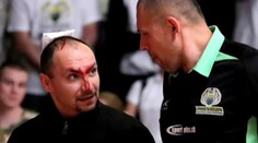 Neskutočný zvrat v Prievidzi. Skrvavený rozhodca a šialene smutní ľudia