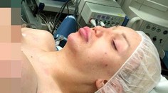 Drobné telo modelky neustálo obrie implantáty. Akútna operácia