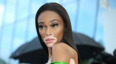 VIDEO: Chaos na VC Kanady. Modelka odmávala cieľ o kolo skôr