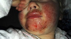 Takto dopadlo dievčatko po jedinom bozku od príbuzného