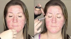 Šikovný zásah vizážistky. Žene zakryla akné bezchybným mejkapom