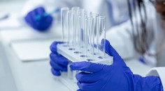 Objavil sa smrteľný vírus, prenášajú ho malé zvieratá. Nemecko hlási už tri obete