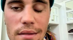 Úsmev od Pfizera je najnovší hoax. Týka sa ochrnutia tváre speváka Justina Biebera