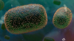 V Česku potvrdili druhý prípad opičích kiahní, ďalšie tri osoby majú príznaky