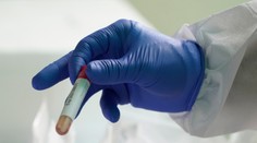 Koronavírus sa začal šíriť medzi staršími ľuďmi, za pondelok celkovo pribudlo 27 infikovaných