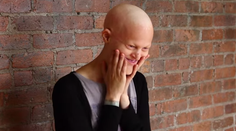 Nemá vlasy ani dokonalú tvár, no predsa je modelka. Zabudnime na povrchnosť