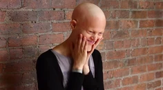 Nemá vlasy ani dokonalú tvár, no predsa je modelka. Zabudnime na povrchnosť