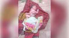 Indka porodila dieťa s ôsmimi končatinami a dvomi tvárami. Reakcia otca mnohých prekvapí