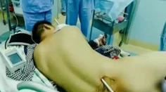 Robotník spadol zo siedmeho poschodia. Zachránil ho hromozvod, ktorý mu prerazil trup