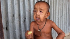 Má štyri roky, ale vyzerá na osemdesiat. Malý chlapec trpí vzácnou chorobou