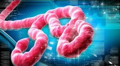 Východným Slovenskom sa šíri vírus podobný ebole. Nie je však dôvod na paniku