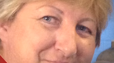 Chcela prirodzený permanentný mejkap. Teraz vyzerá ako klaun