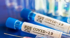 Vakcínu proti koronavírusu začnú v USA testovať v pondelok