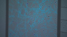 Za epidémiu neplodnosti môžu látky, ktoré sú všade okolo nás. V niektorých prípadoch je príčina záhadou