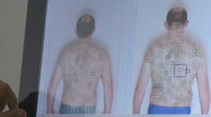 Pozor na UV žiarenie spôsobujúce rakovinu. Na Slovensku najviac ohrozuje tieto skupiny ľudí