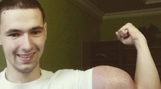 Mladý Rus chcel mať veľké bicepsy, ale bez tréningu. Páčia sa vám?