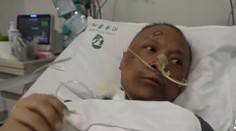 Čínskym lekárom nakazeným COVID-19 stmavla pleť. Ich kolegovia majú zopár teórií