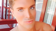 Ďalší živý Ken je na svete. Ako vyzeral pred operáciami?