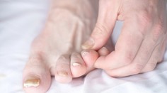 Letné mykózy trápia čoraz viac ľudí. Odborníčka radí, ako im predchádzať