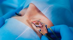 Konečne mali žiť naplno, no stal sa pravý opak. O rizikách operácií očí nám nepovedali všetko, tvrdia obete