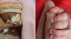 Úžasné! Dievčatko malé ako dlaň dnes nespoznáte