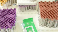 Minister Krajčí nástojí na masívnom testovaní. Prípravy na vakcináciu sú podľa neho v plnom prúde