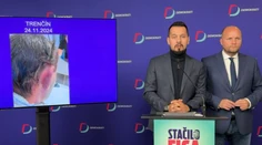 Inšpekcia reaguje na údajne hrubý zásah polície v Trenčíne: Mužovi ucho nenatrhli policajti