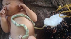 Odborníci varujú pred lotosovým pôrodom. Dieťa je niekoľko dní spojené s placentou