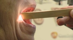 Rapídne stúpa rakovina hlavy a krku. Aj kvôli orálnemu sexu