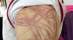 Nevlastná matka surovo dobila chlapca. Môže za to Pinocchio