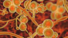 Zabíja oslabených pacientov. Nebezpečnou kvasinkovou infekciou sa nakazila už aj prvá Slovenka