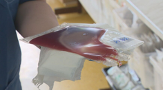 Stále viac matiek tvrdí, že ich tlačili do darovania pupočníkovej krvi. Niektoré pôrodnice darcovské odbery stopli