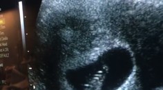 Hviezda Tudorovcov zverejnila video so zdrvujúcou správou. Srdiečko bábätka už nebilo