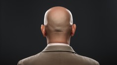 Nádej pre "nespravodlivo" plešatých ľudí. Vedci prelomili poslednú bariéru