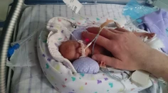 Po pôrode nevážila ani pol kila. Zachránilo ju aj igelitové vrecko od známeho reťazca