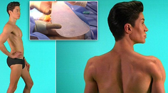 VIDEO: Ľudský Ken podstúpil ďalšiu operáciu. Chrbát ako krídla