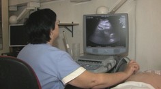 Odborník vyvsvetlil, v čom spočívajú úskalia návrhu zákona, ktorý sprísňuje interrupcie