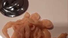 VIDEO: Muža vyľakal na toalete hrozivý pohľad. Z tela si vybral živú pásomnicu