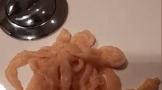 VIDEO: Muža vyľakal na toalete hrozivý pohľad. Z tela si vybral živú pásomnicu