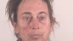 Ďalší príklad, že steroidy sú zlé. Toto bola kedysi pekná žena!