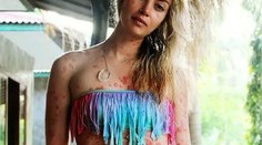 Dievča si kvôli psoriáze prechádza peklom. Teraz to chce zmeniť