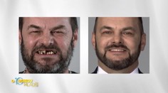 Zo zanedbaného muža šarmantný elegán: Pozrite si výsledok ďalšej skvostnej premeny