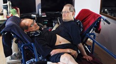 Vo veku 68 rokov zomreli najstaršie žijúce siamské dvojčatá