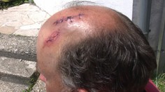 Rybári upozornili skupinu mužov na hlučné správanie. Tá ich dobila poriskom a reťazou