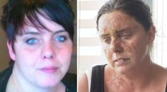 Útok, aký v civilizovanom svete nemá obdoby. Ženu poliali kyselinou