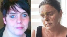 Útok, aký v civilizovanom svete nemá obdoby. Ženu poliali kyselinou