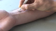 Zázračná ceruzka! Odhalí aj tie najzákernejšie choroby