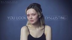 "Si škaredá ako hov..!" Dievča vo videu ukazuje, akí sú ľudia na internete krutí