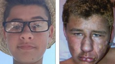 Ničivý živel mu znetvoril tvár. Operovali ho šesť hodín